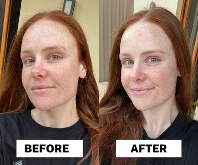 Stravae vitamin c serum